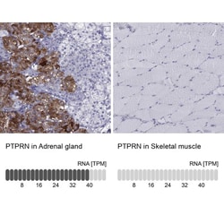 IA-2/PTPRN Antibody, Novus Biologicals:Antibodies:Primary Antibodies